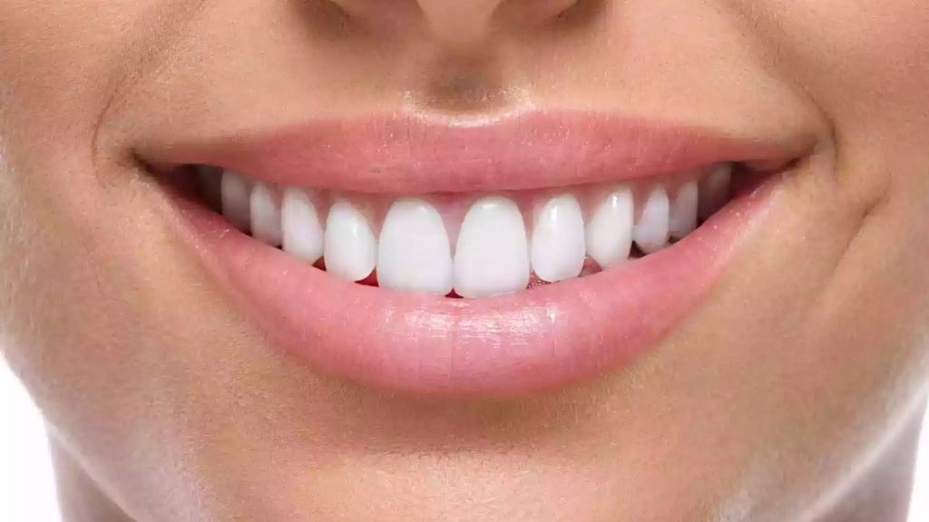 Teeth Whitening